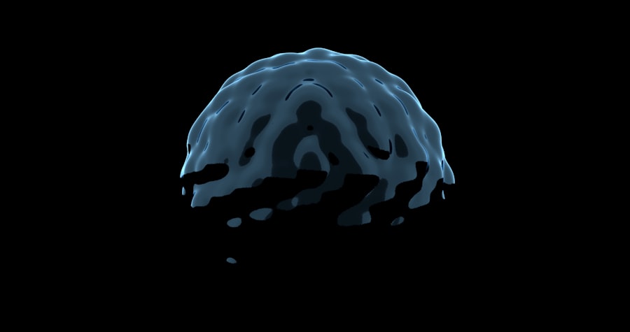 Photo Brain scan